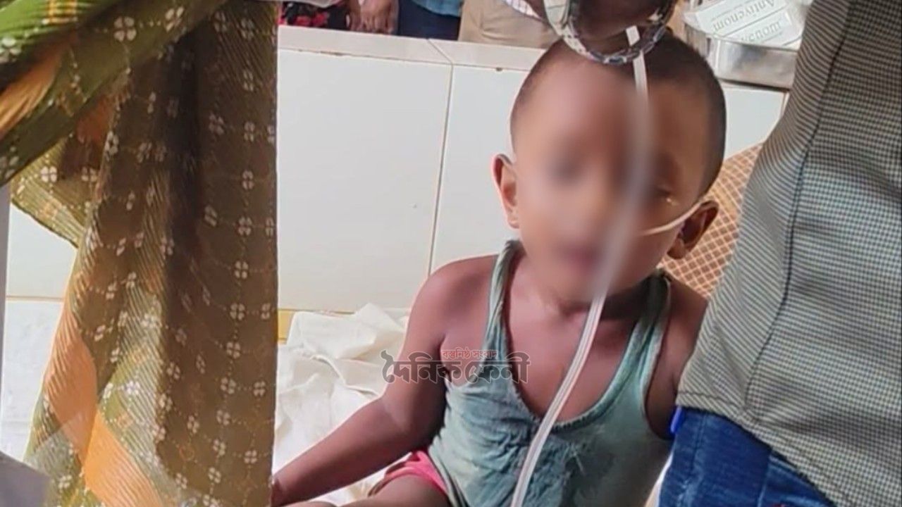 চিকিৎসায় প্রাণে বাঁচল শিশু রাফাত
